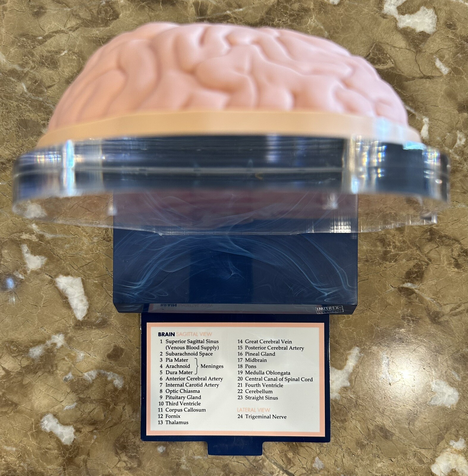 Imitrex (Sumatriptan) 3D 9″ Neuroanatomy Model with Legend – Brain Anatomy