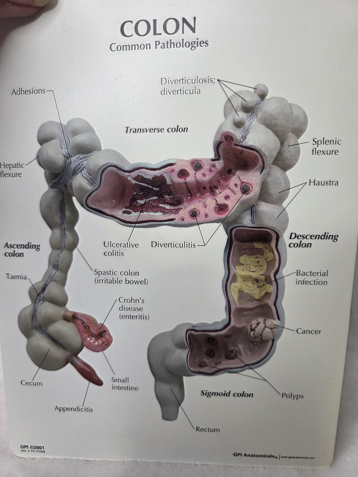 Colon Display GPI Anatomicals 2001