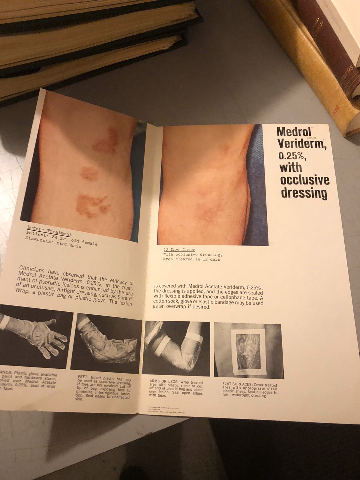 Dermatology Brochure Psoriasis Medrol Veriderm Upjohn Skin Atopic