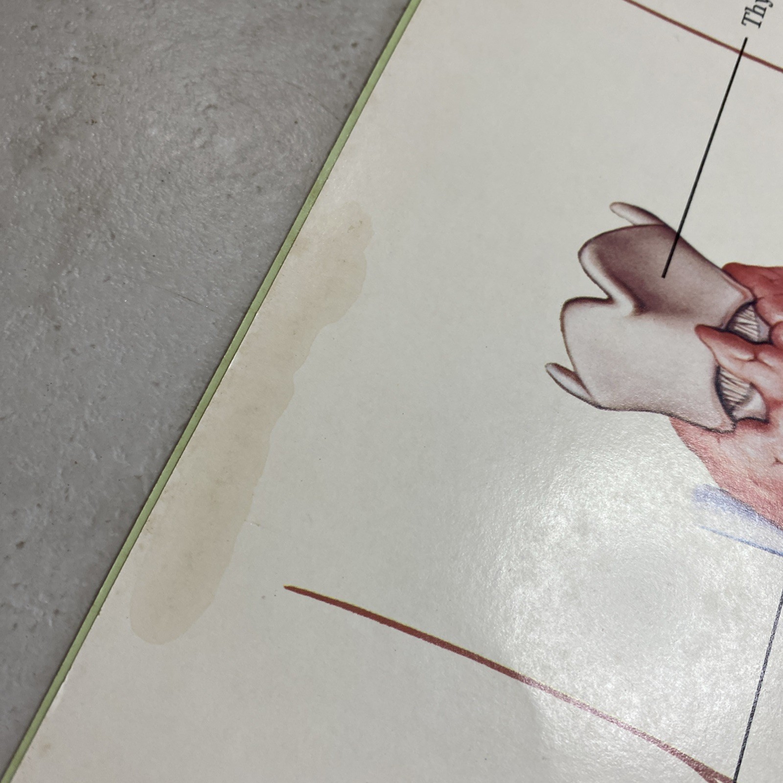 1975 Eli Lilly Pharmaceutical Medical Illustrations Of Surgical Anatomy Macabre
