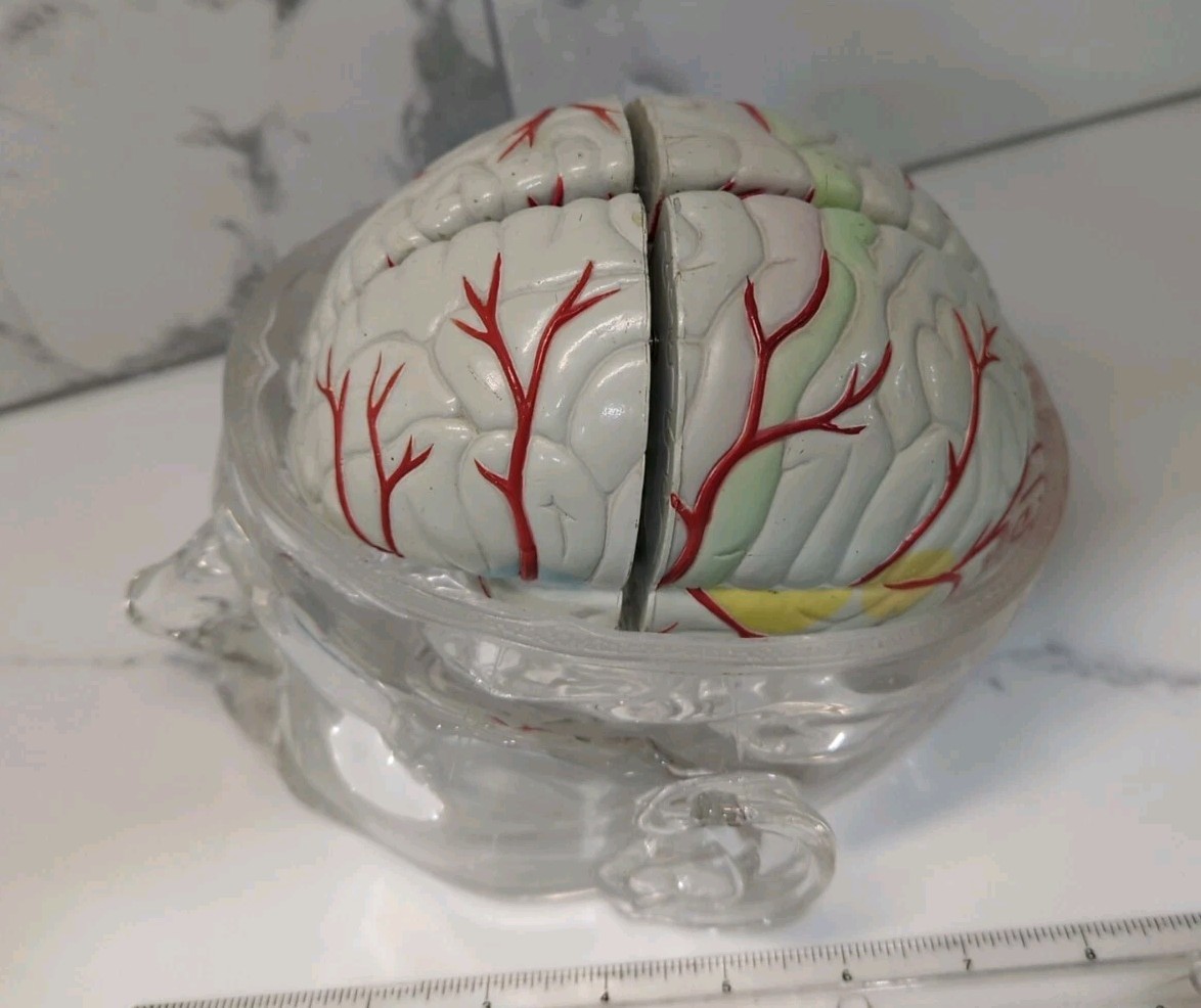 Gliadel Human Brain Anatomy Model w/ Clear Skull PharmaDesign Medical Display