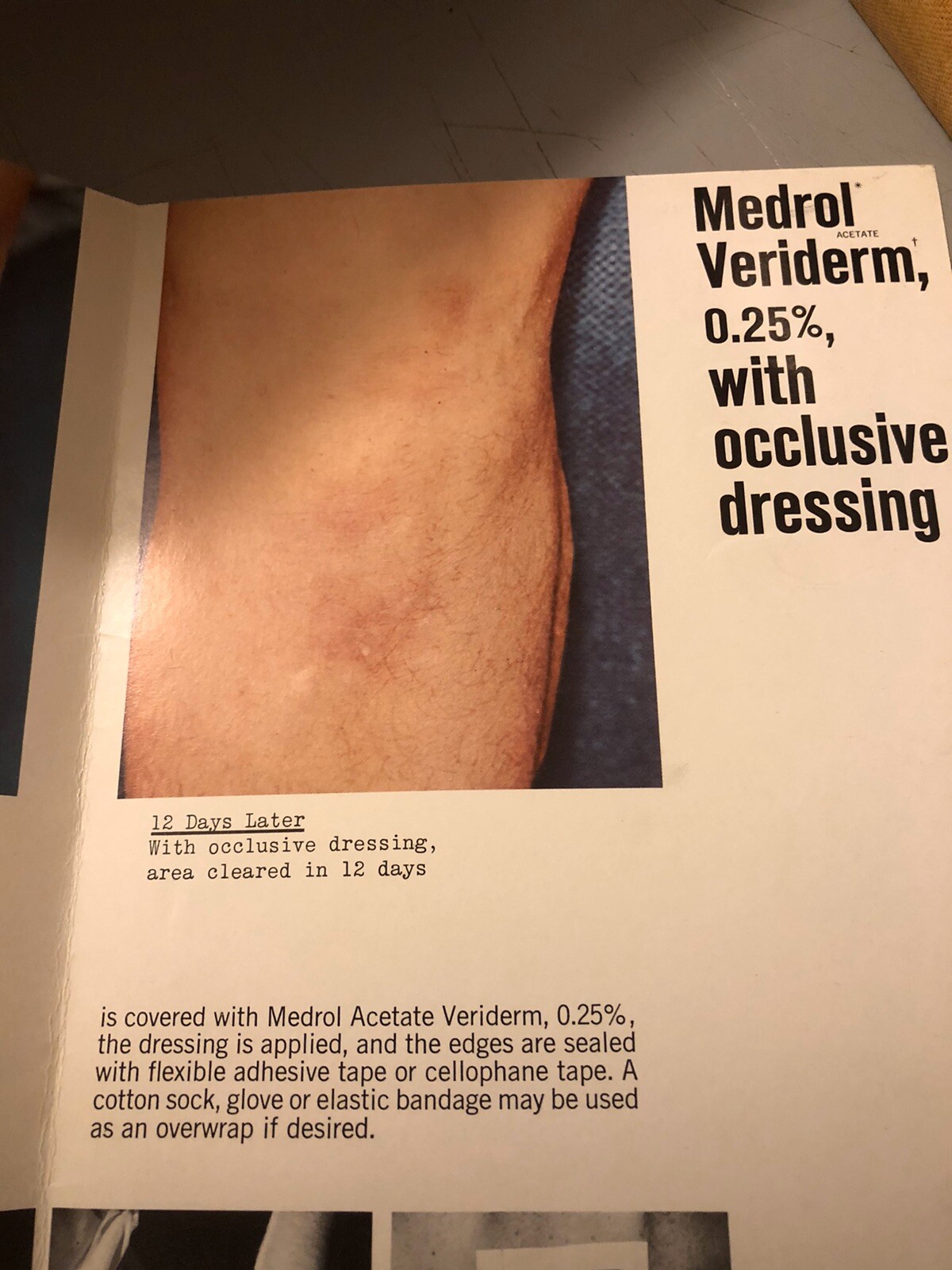 Dermatology Brochure Psoriasis Medrol Veriderm Upjohn Skin Atopic