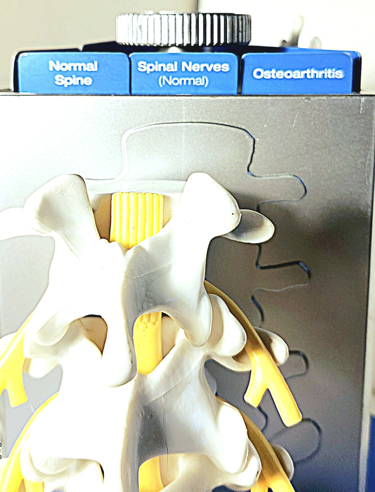 “Anatomical Arthritis Model” Of a Hand, Foot, & Spine ~Pfizer~ Celebrex/Bextra