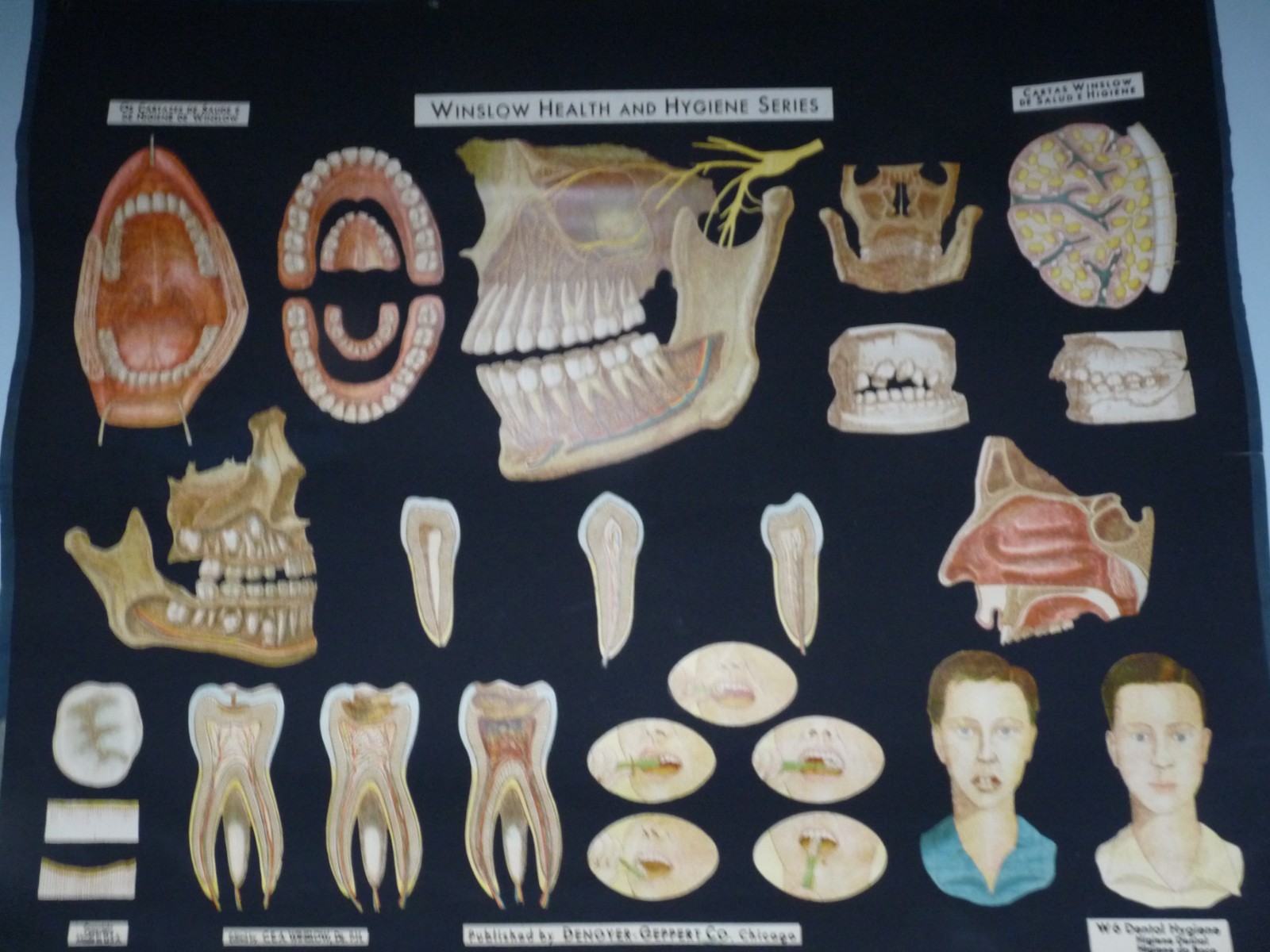 “DENTAL HYGIENE” 1930S PULL DOWN MEDICAL CHART , DENOYER GEPPERT 44X36