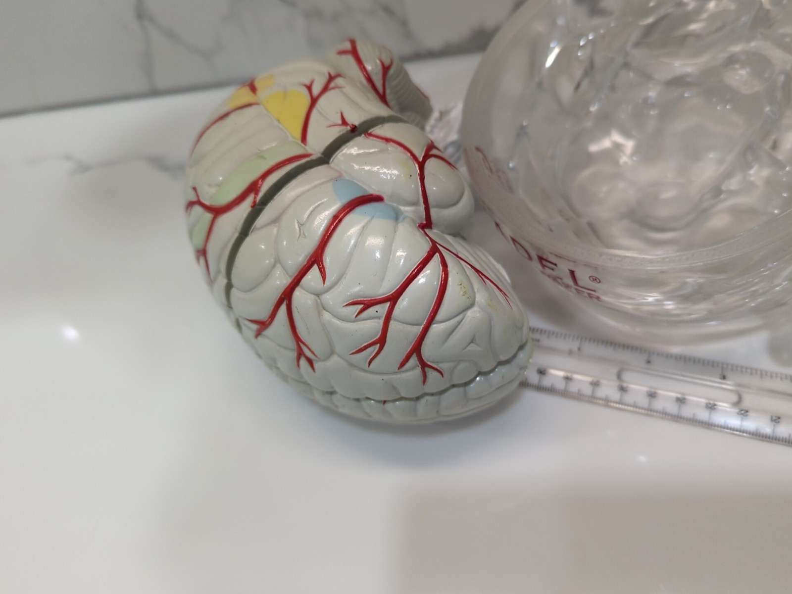 Gliadel Human Brain Anatomy Model w/ Clear Skull PharmaDesign Medical Display