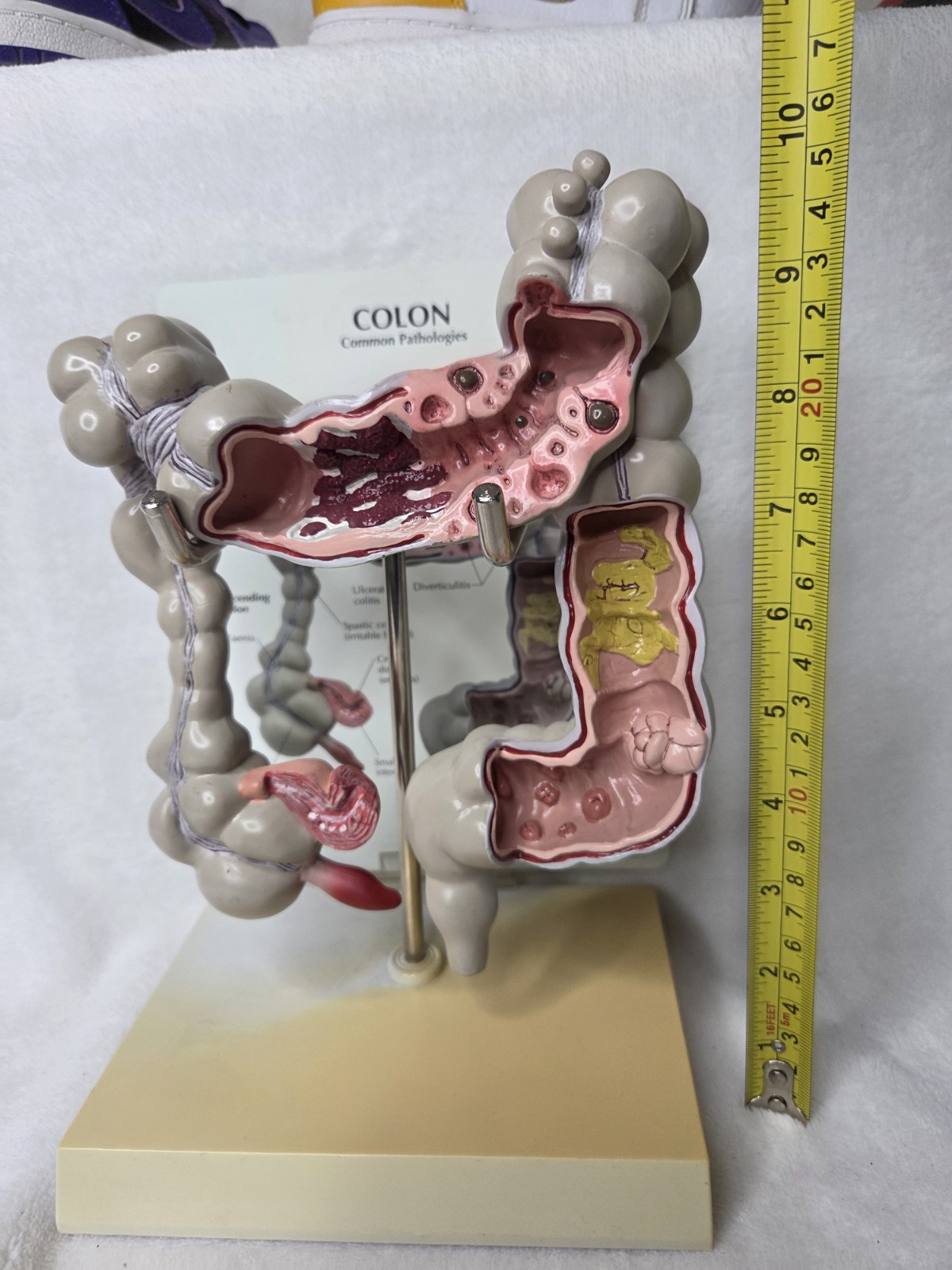 Colon Display GPI Anatomicals 2001