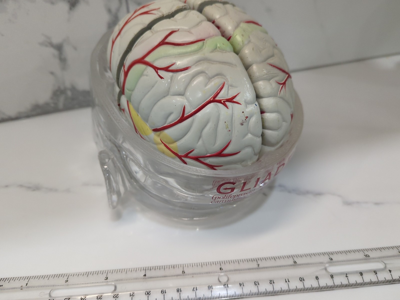 Gliadel Human Brain Anatomy Model w/ Clear Skull PharmaDesign Medical Display