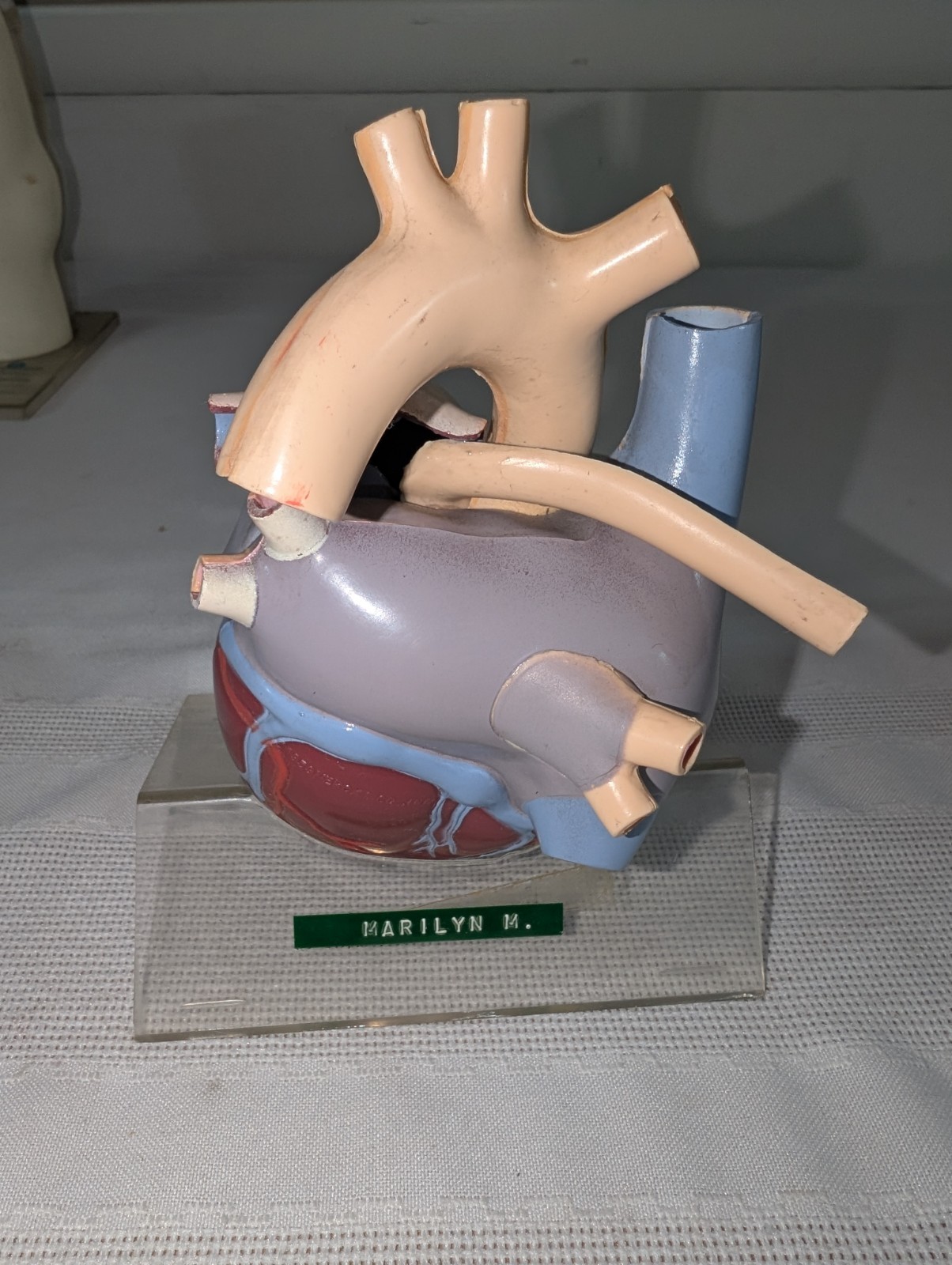 1960s Merck Pharmaceutical Advertising Model “Hydrodiuril Hydropres” Model