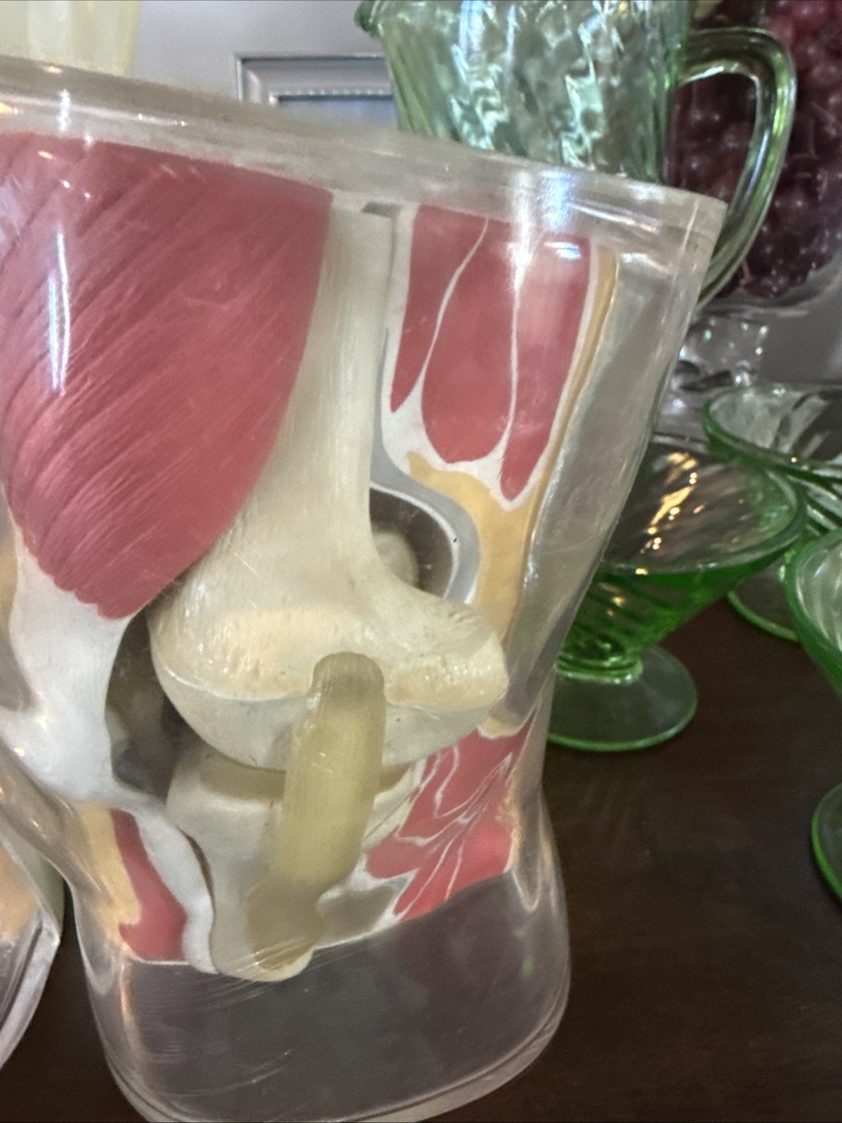 Vintage 1962 Human Knee Merck & Co Medical Anatomical Model Set Of 2 One Price