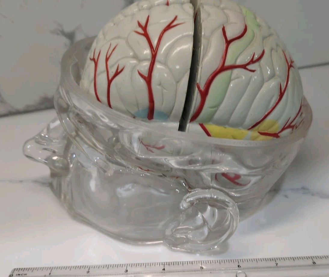 Gliadel Human Brain Anatomy Model w/ Clear Skull PharmaDesign Medical Display