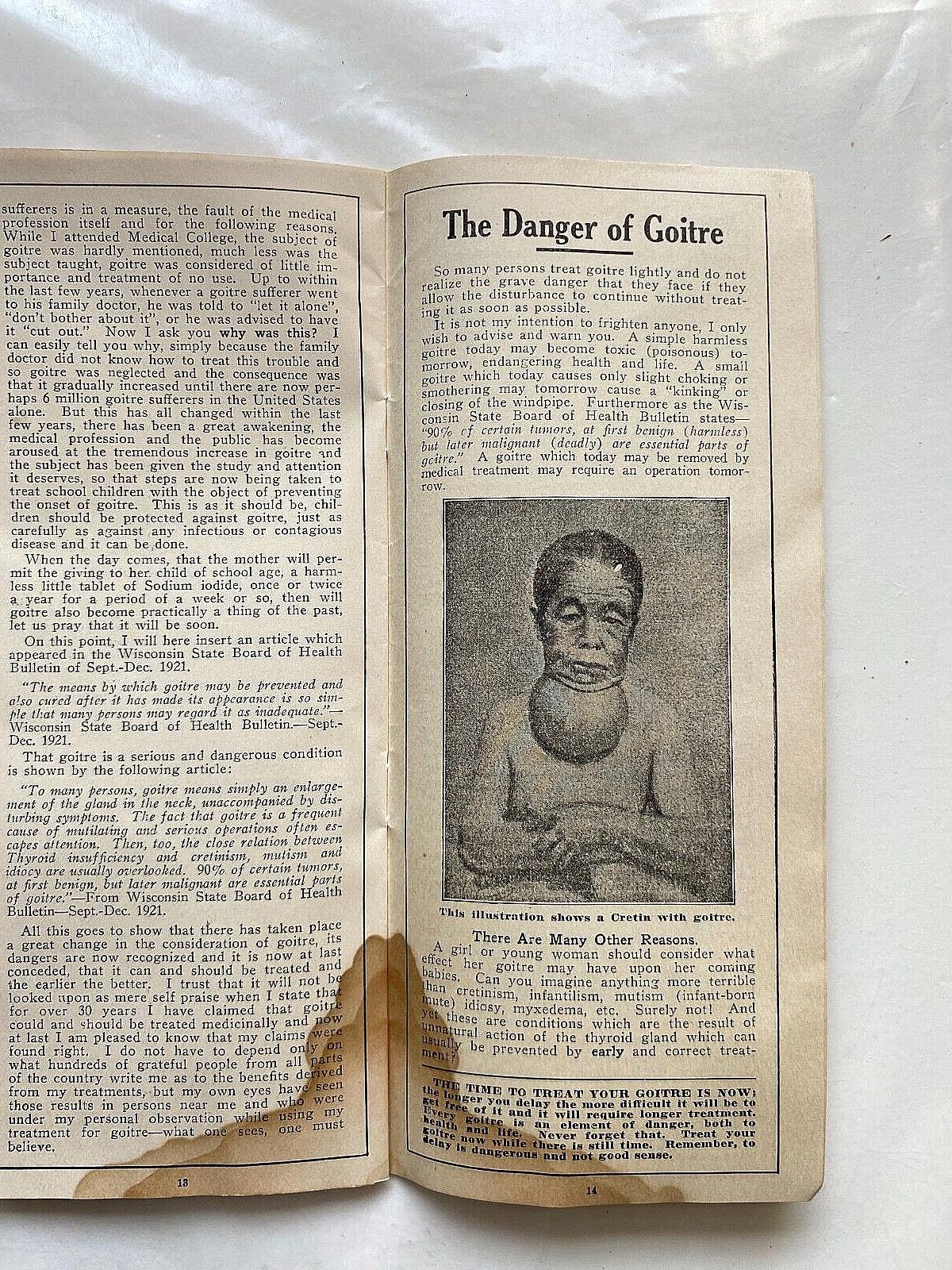 1932 Sales Literature for Goitre Cure. Dr. Arthur Rock, Milwaukee, Wisconsin.