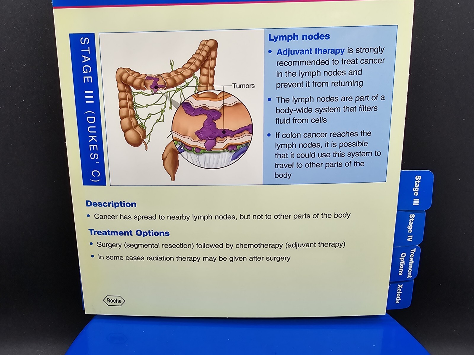 NIB Roche Pharmaceutical Xeloda Colon Cancer Anatomical Model & Chart Display