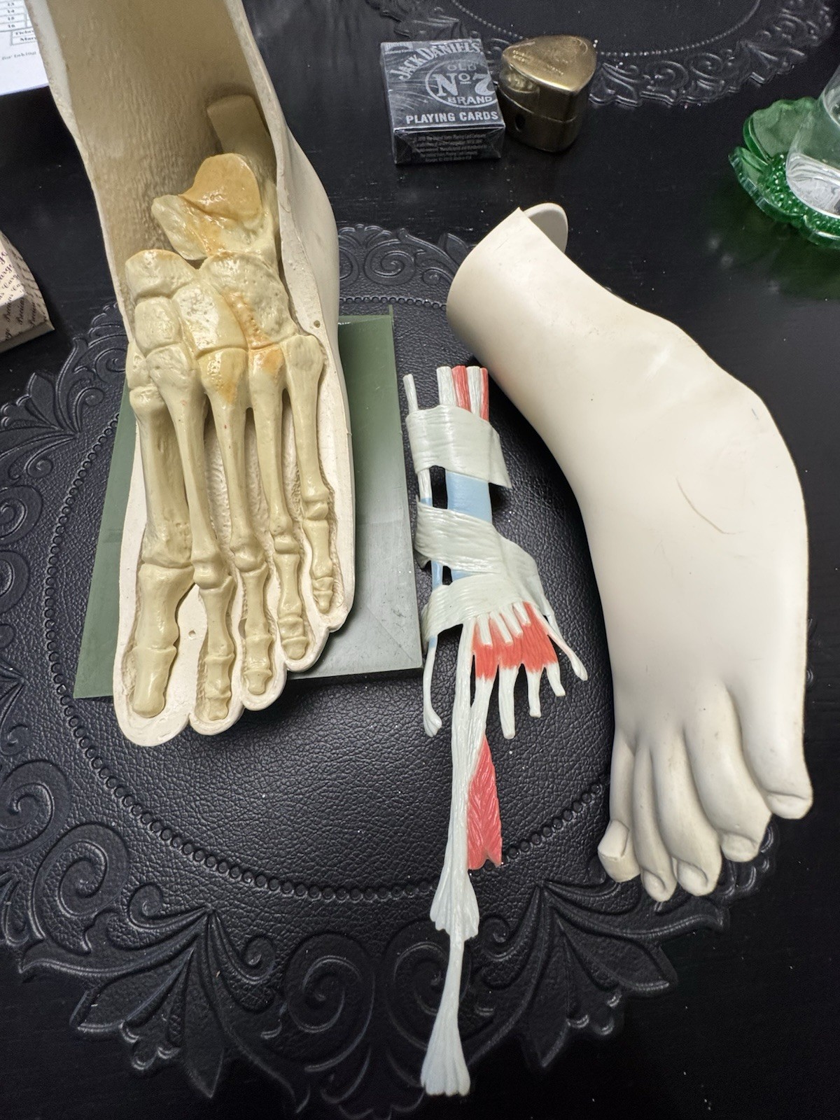 Vintage Merck Benemid/Indocin Advertising Display Foot Anatomical Store Model