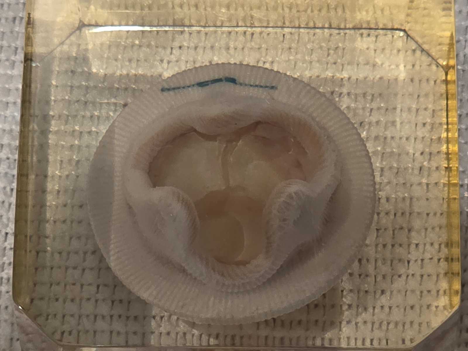 Vintage Hancock Heart Valve Bioprosthesis Display