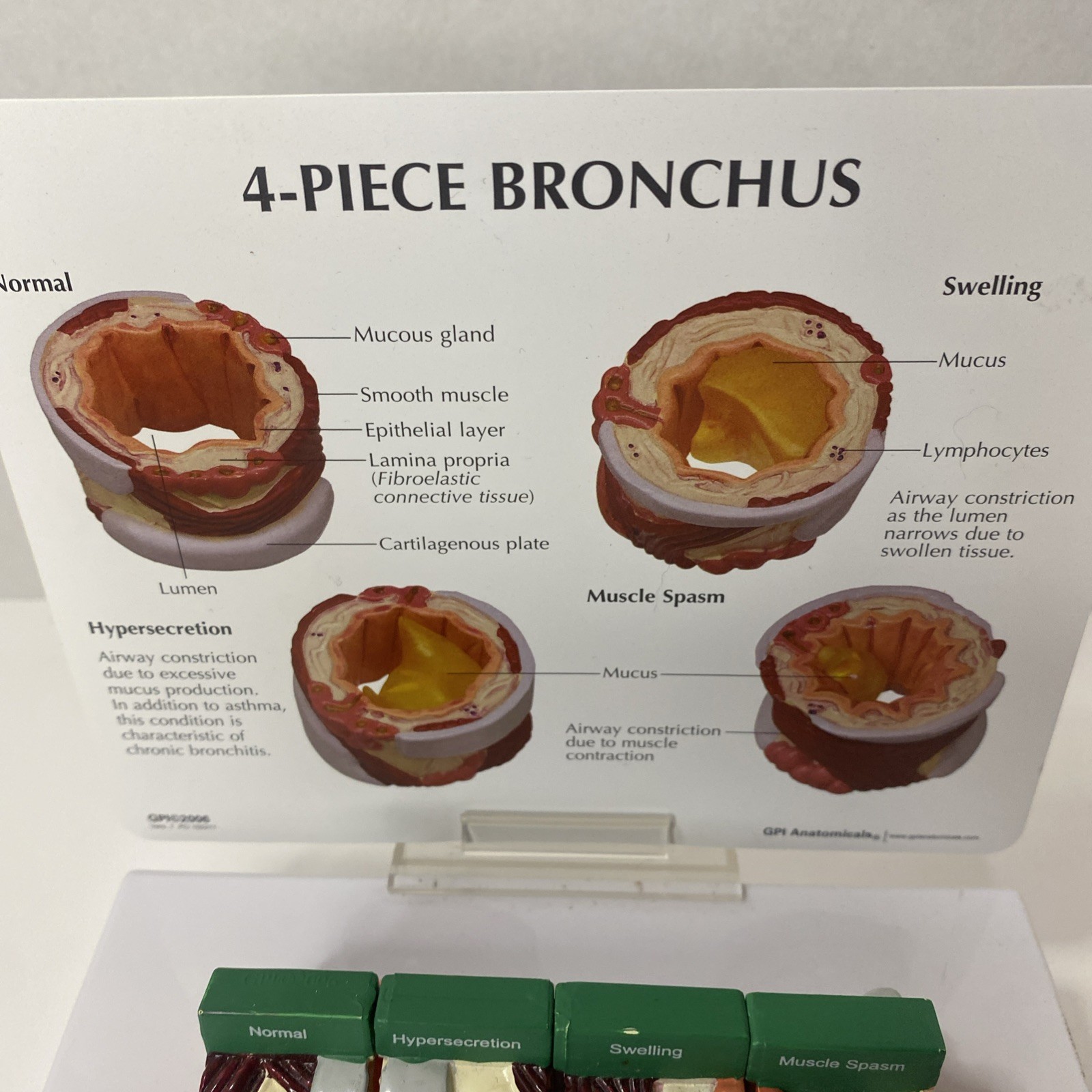 AstraZeneca Bronchus Airway Medical Anatomical Model Doctor Office Display