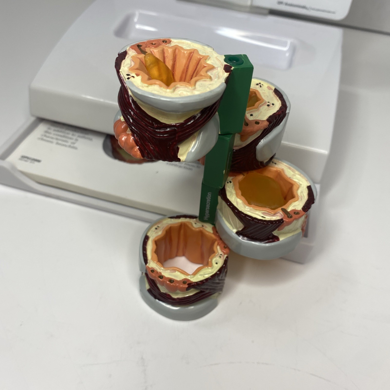 AstraZeneca Bronchus Airway Medical Anatomical Model Doctor Office Display