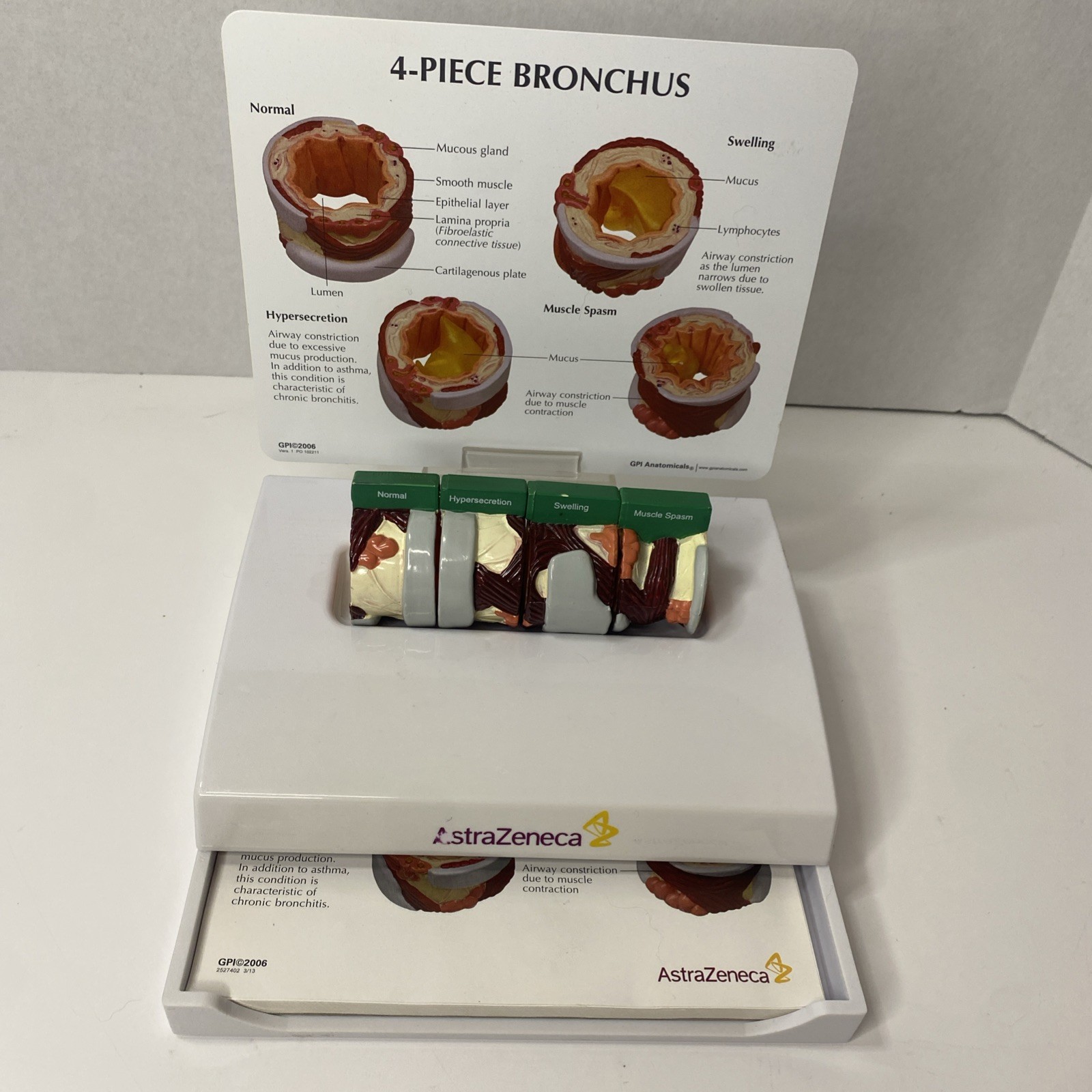 AstraZeneca Bronchus Airway Medical Anatomical Model Doctor Office Display