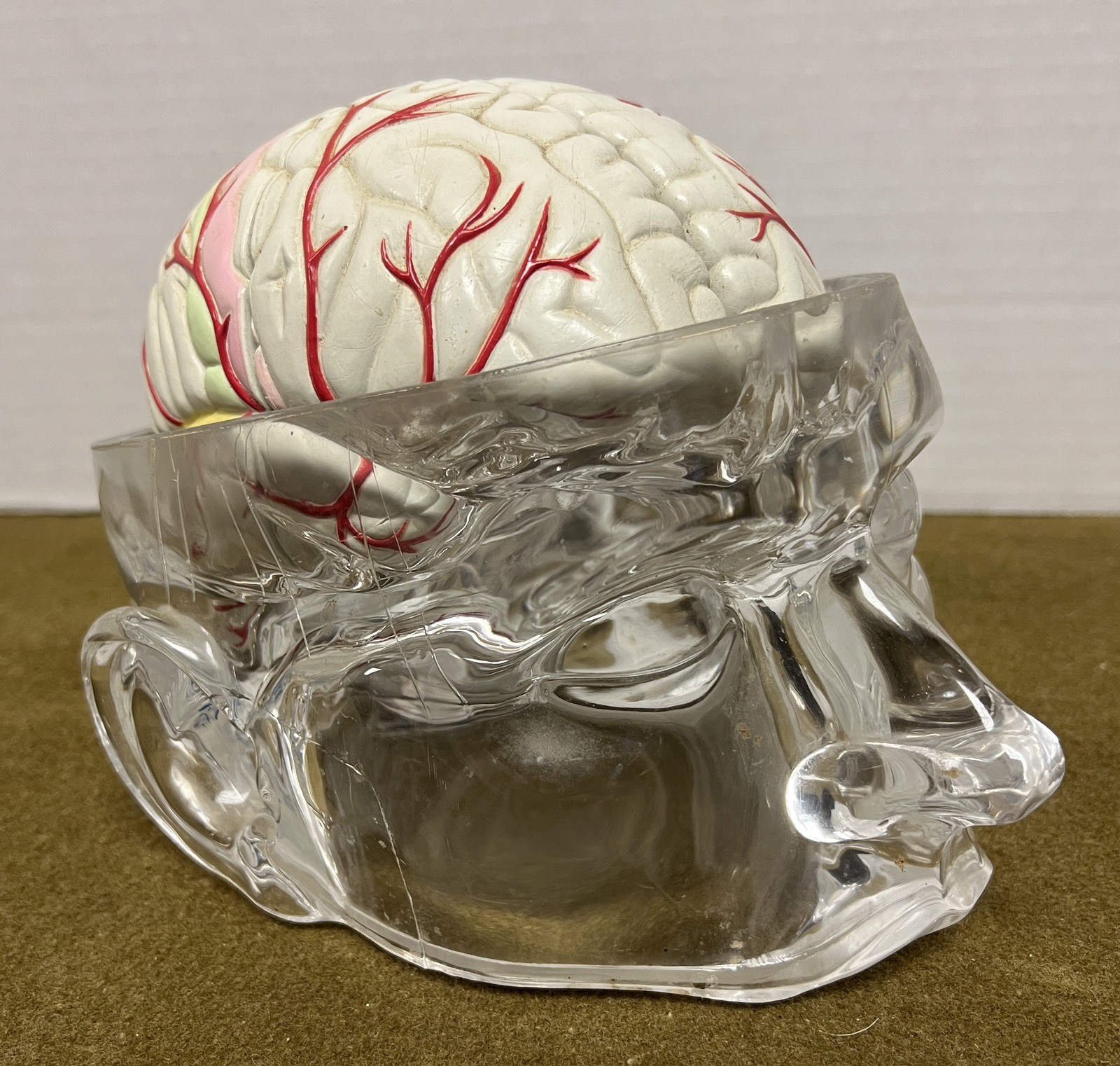 Seroquel Brain Model Pharmaceutical Advertising Display Research