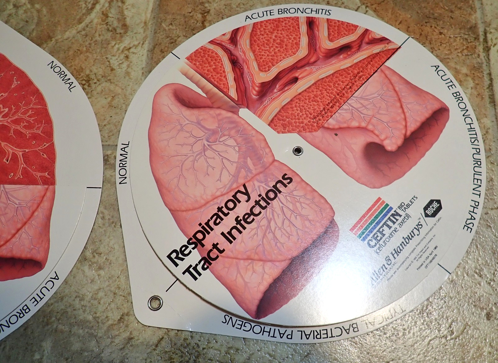 Lot of 4 Respiratory Tract Infections Wheel Medical Displays CEFTIN Advertising