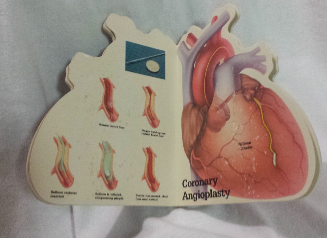 Heart Book Patient Guide to the Human Heart Transderm Nitro Advertising Medical