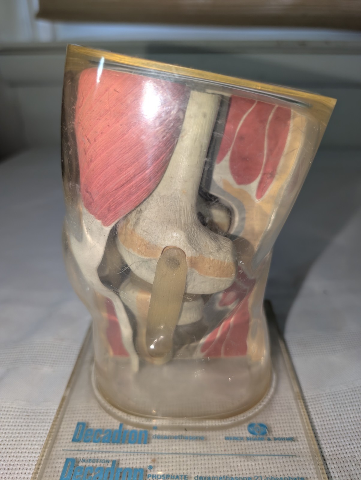 1960s Merck Pharmaceutical Advertising Model “Decadron” Knee Model