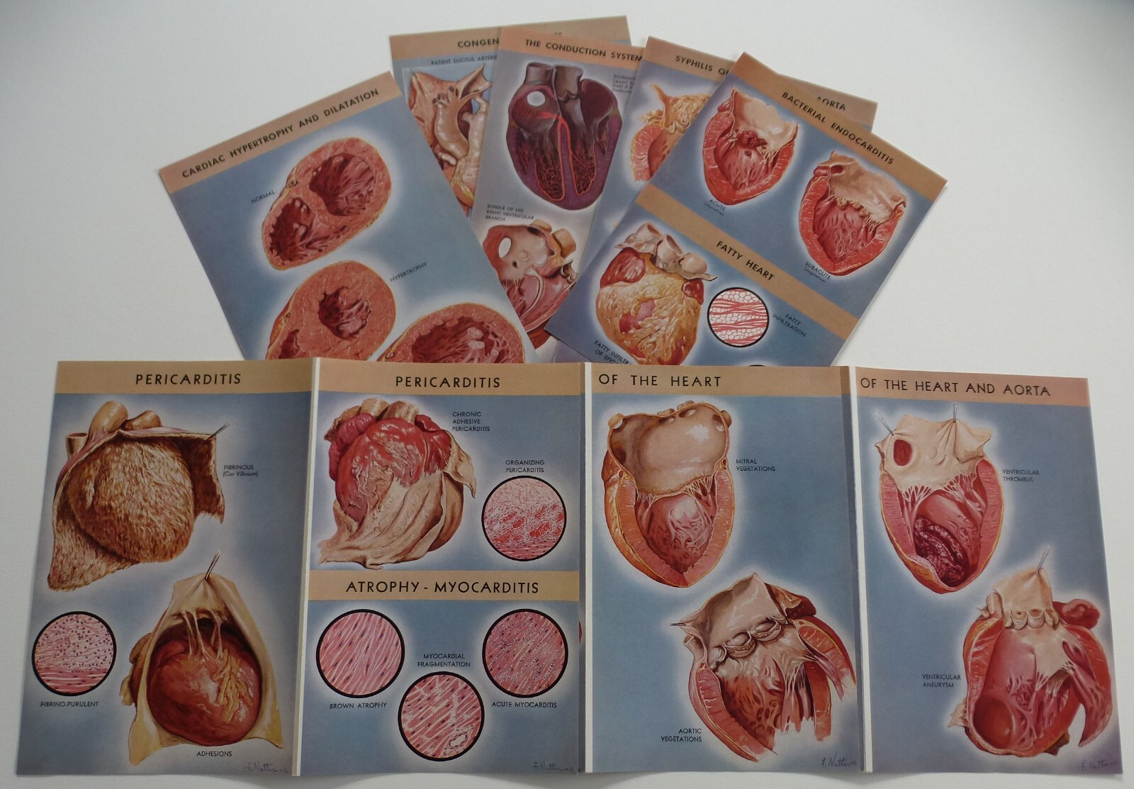 18 Ciba Pharmaceutical Folders w/ Color Plates – Pathology Anatomy War Injuries