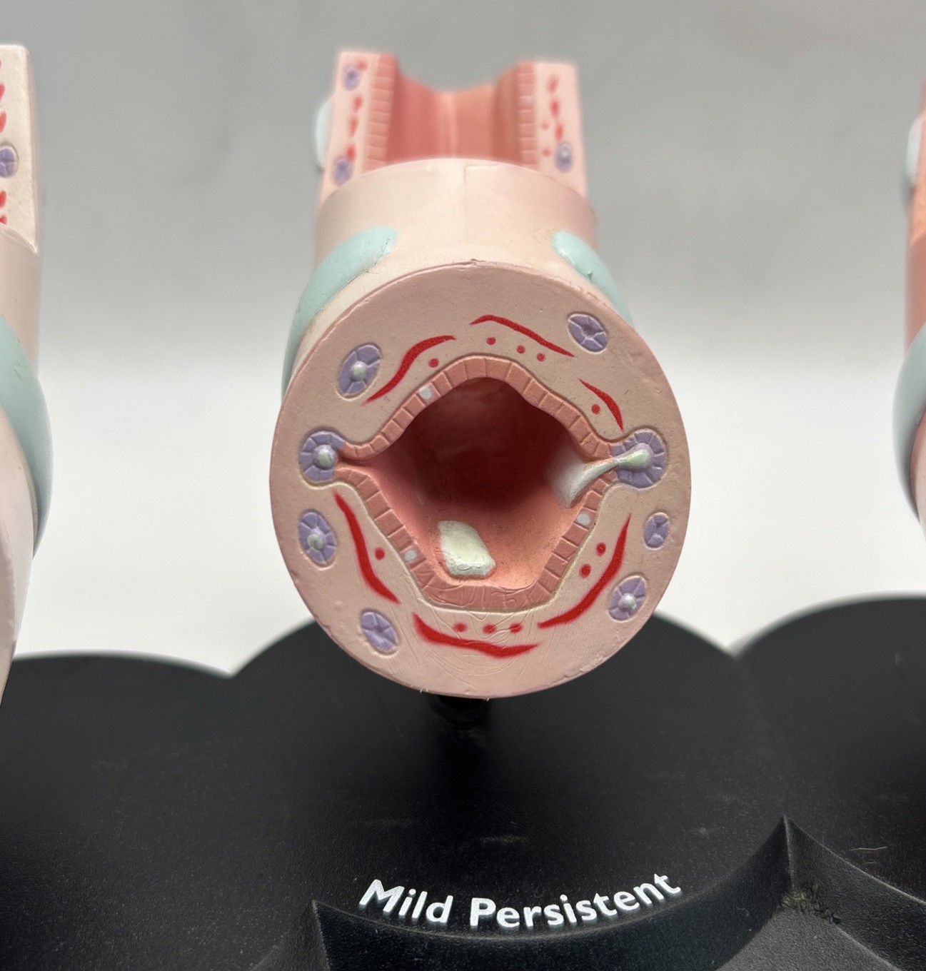 Flovent Asthma Trachea Bronchus Anatomical Pathology Model Pharmadesign 1999