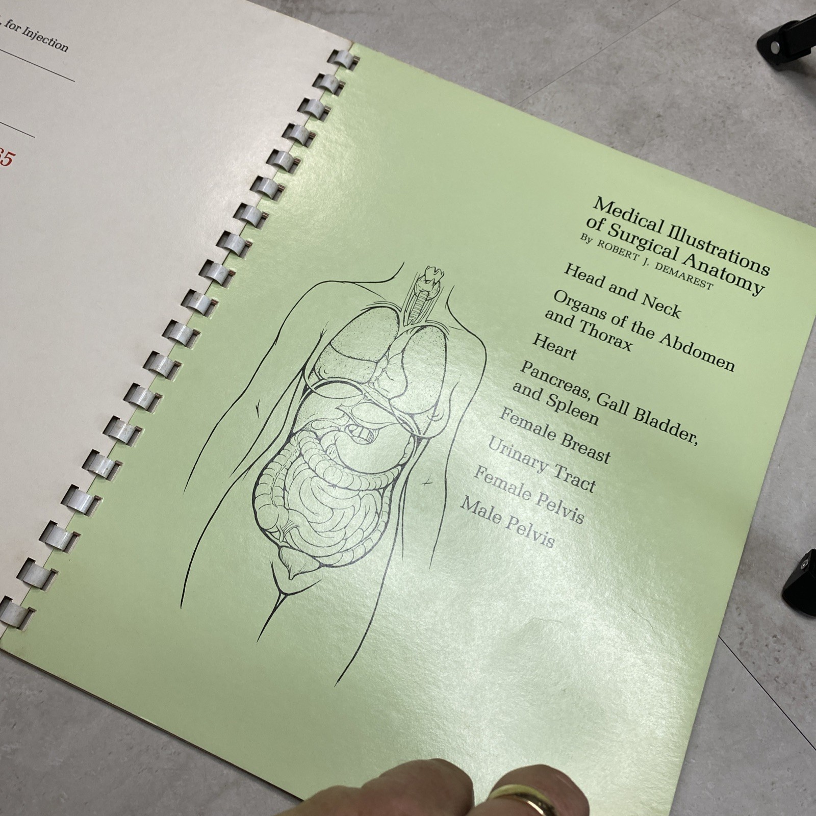 1975 Eli Lilly Pharmaceutical Medical Illustrations Of Surgical Anatomy Macabre
