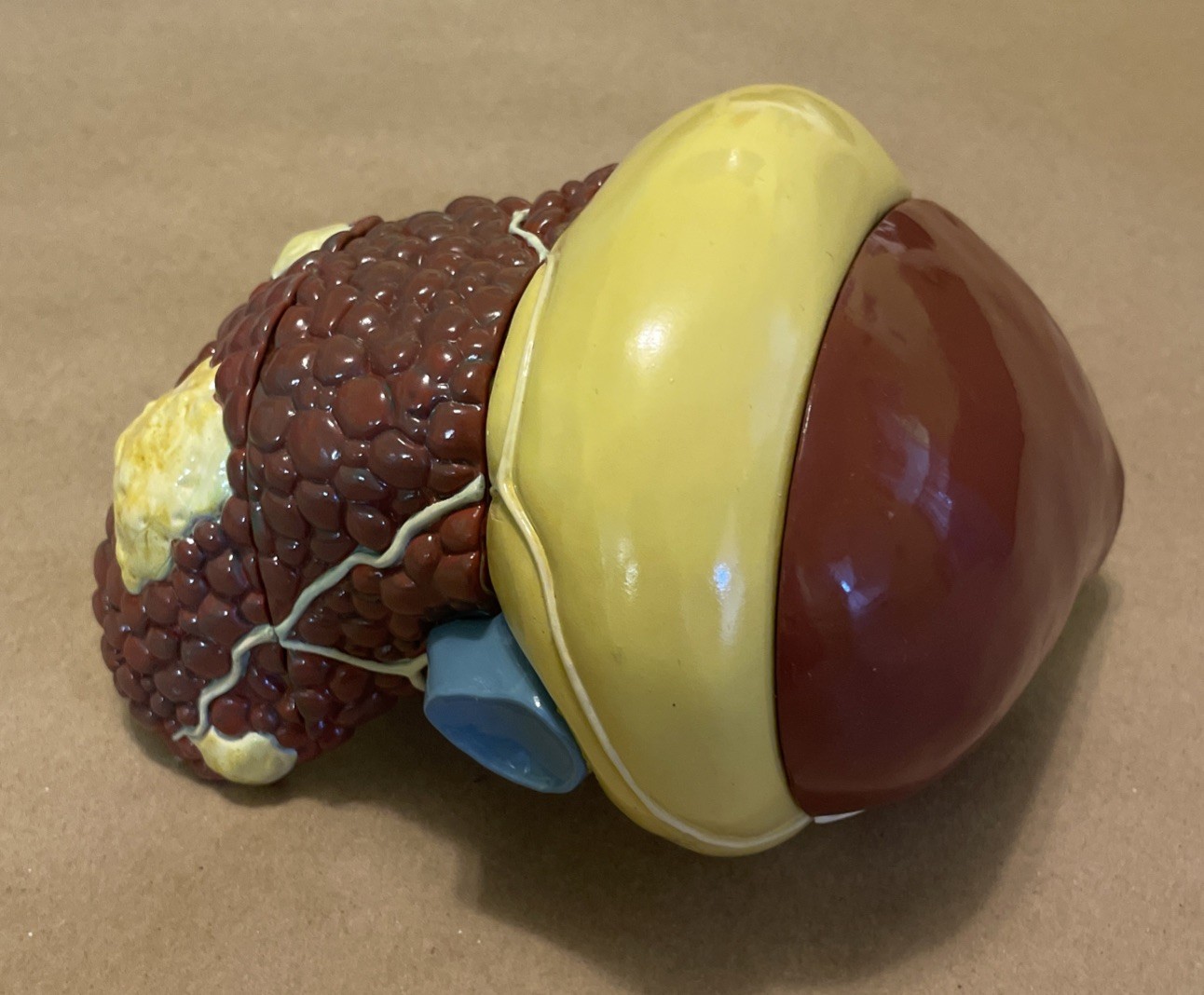 Diseased Liver Anatomical Teaching Model Schering Oncology Biotech Pharmadesign