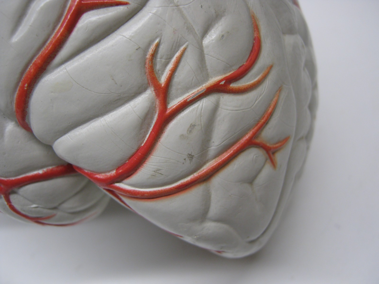 Seroquel Human Brain Anatomy Model w/ Clear Skull PharmaDesign Medical Display