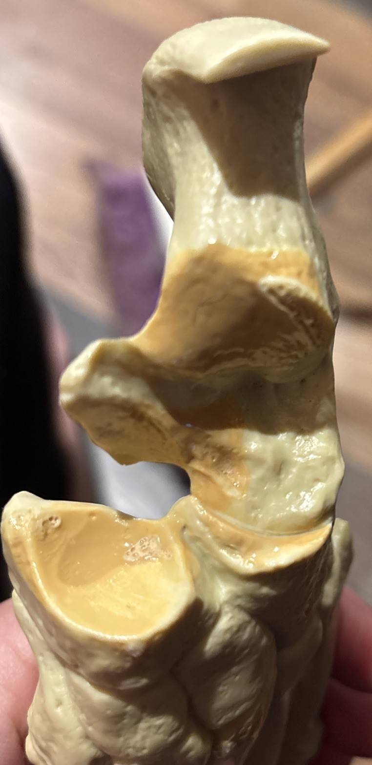 Anatomical foot display – Merck, Sharp & Dohme, please read