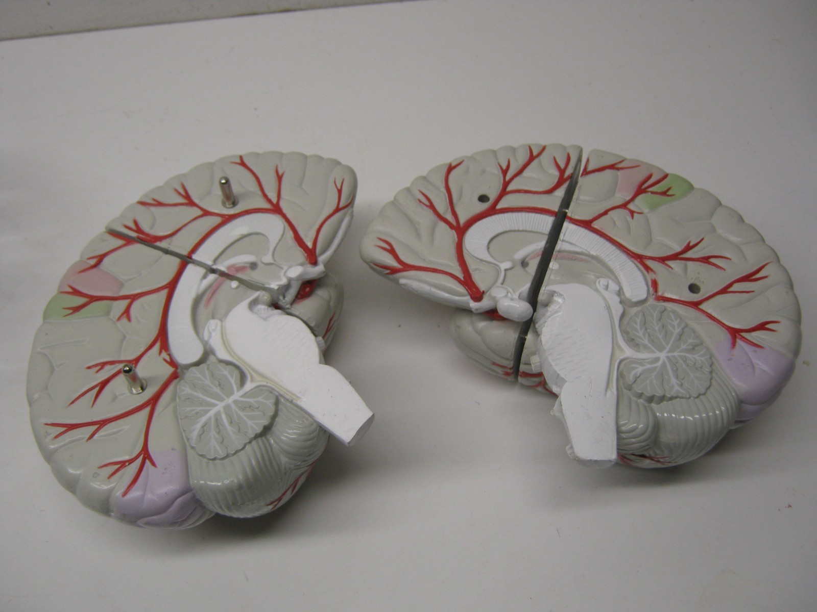 Seroquel Human Brain Anatomy Model w/ Clear Skull PharmaDesign Medical Display