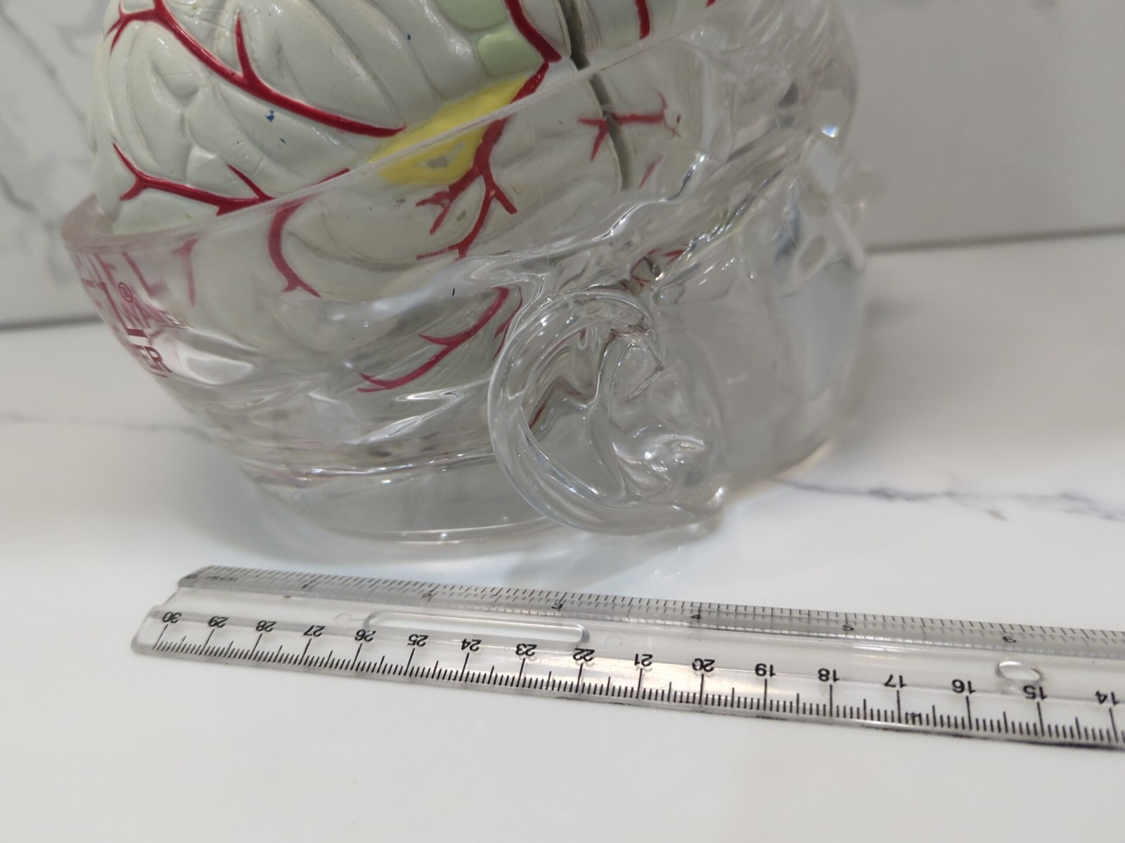 Gliadel Human Brain Anatomy Model w/ Clear Skull PharmaDesign Medical Display