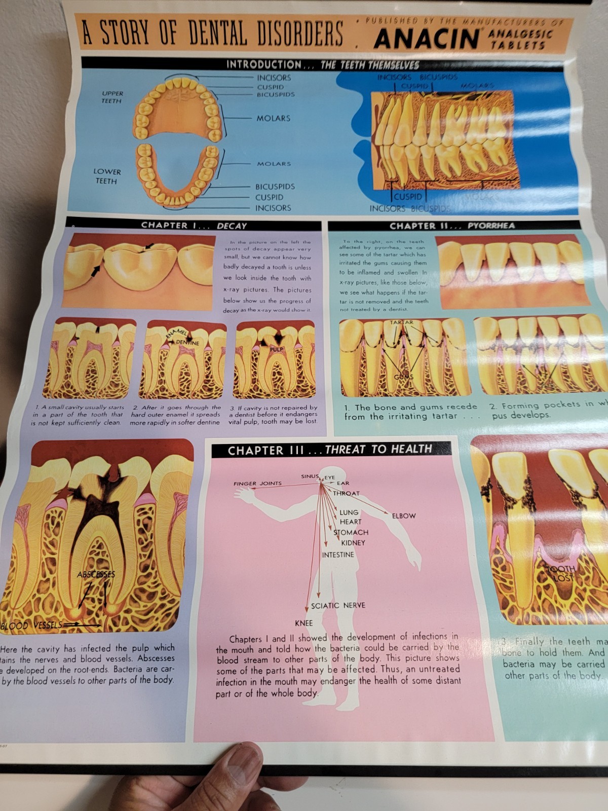 Vintage ANACIN Tablets WHITEHALL Laboratories ADVERTISING Dentist DENTAL POSTER