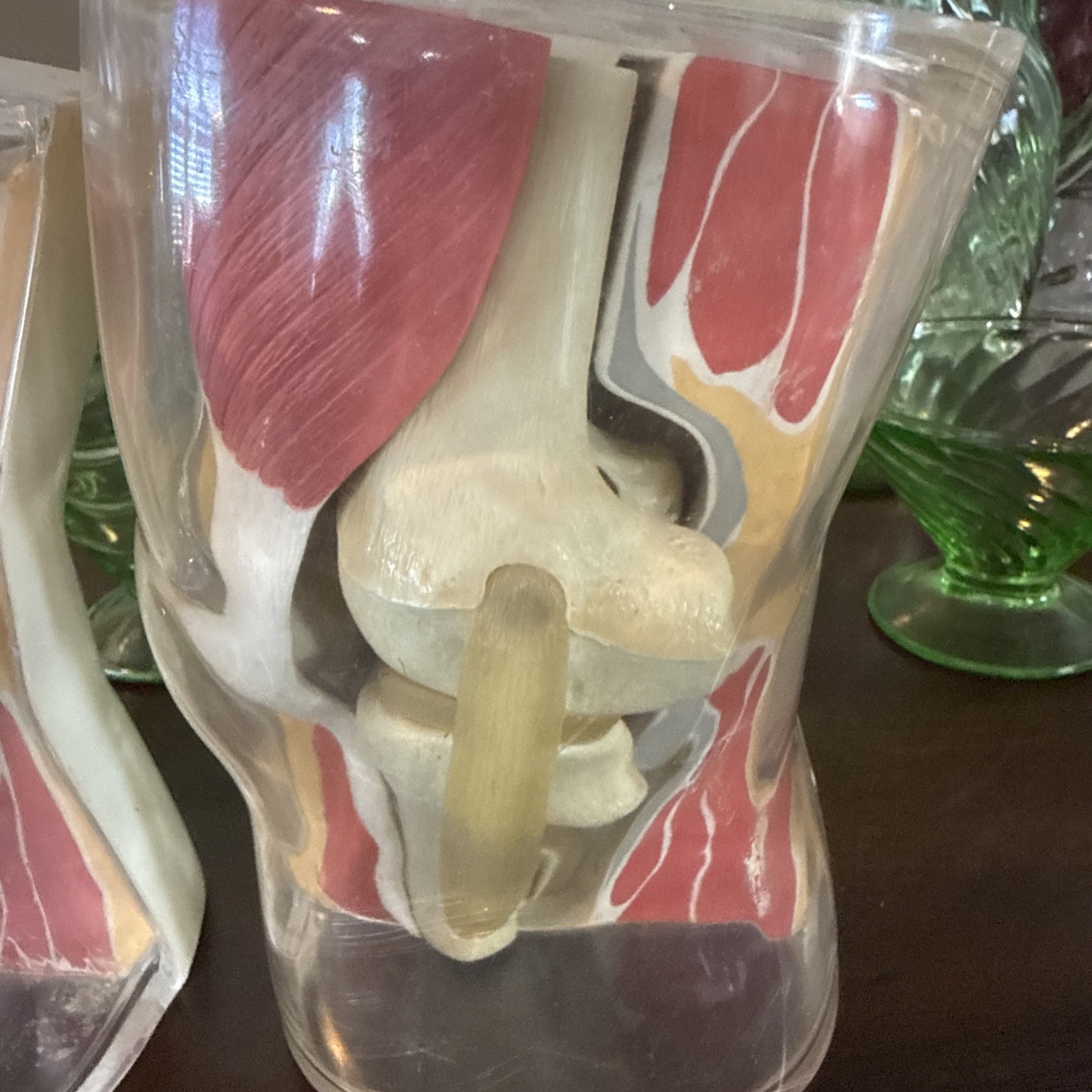Vintage 1962 Human Knee Merck & Co Medical Anatomical Model Set Of 2 One Price