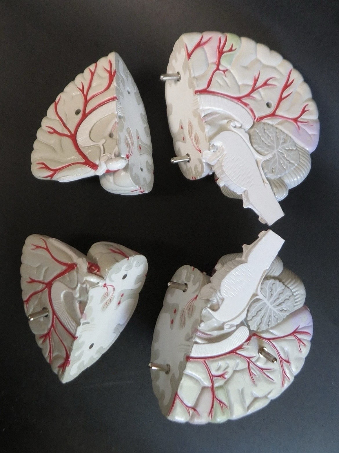 Seroquel Rx Skull Brain Science Model Medical Pharmaceutical Ad Premium Display