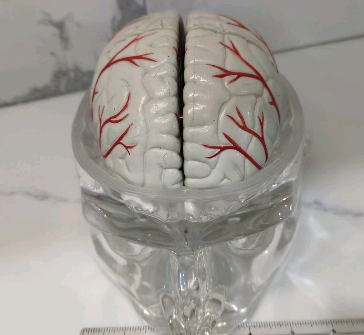 Gliadel Human Brain Anatomy Model w/ Clear Skull PharmaDesign Medical Display
