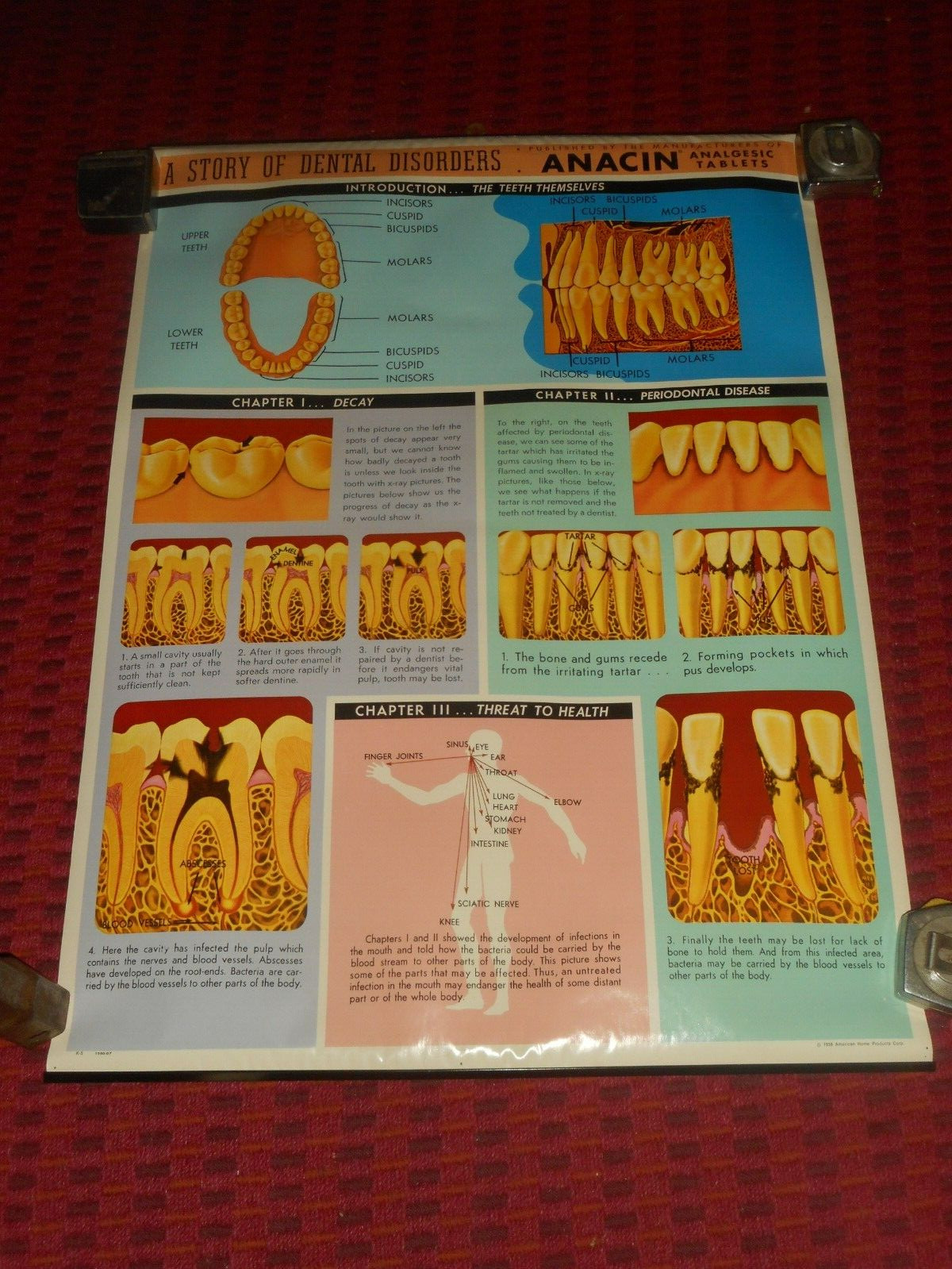 Vintage ANACIN Tablets WHITEHALL Laboratories ADVERTISING Dentist DENTAL POSTER