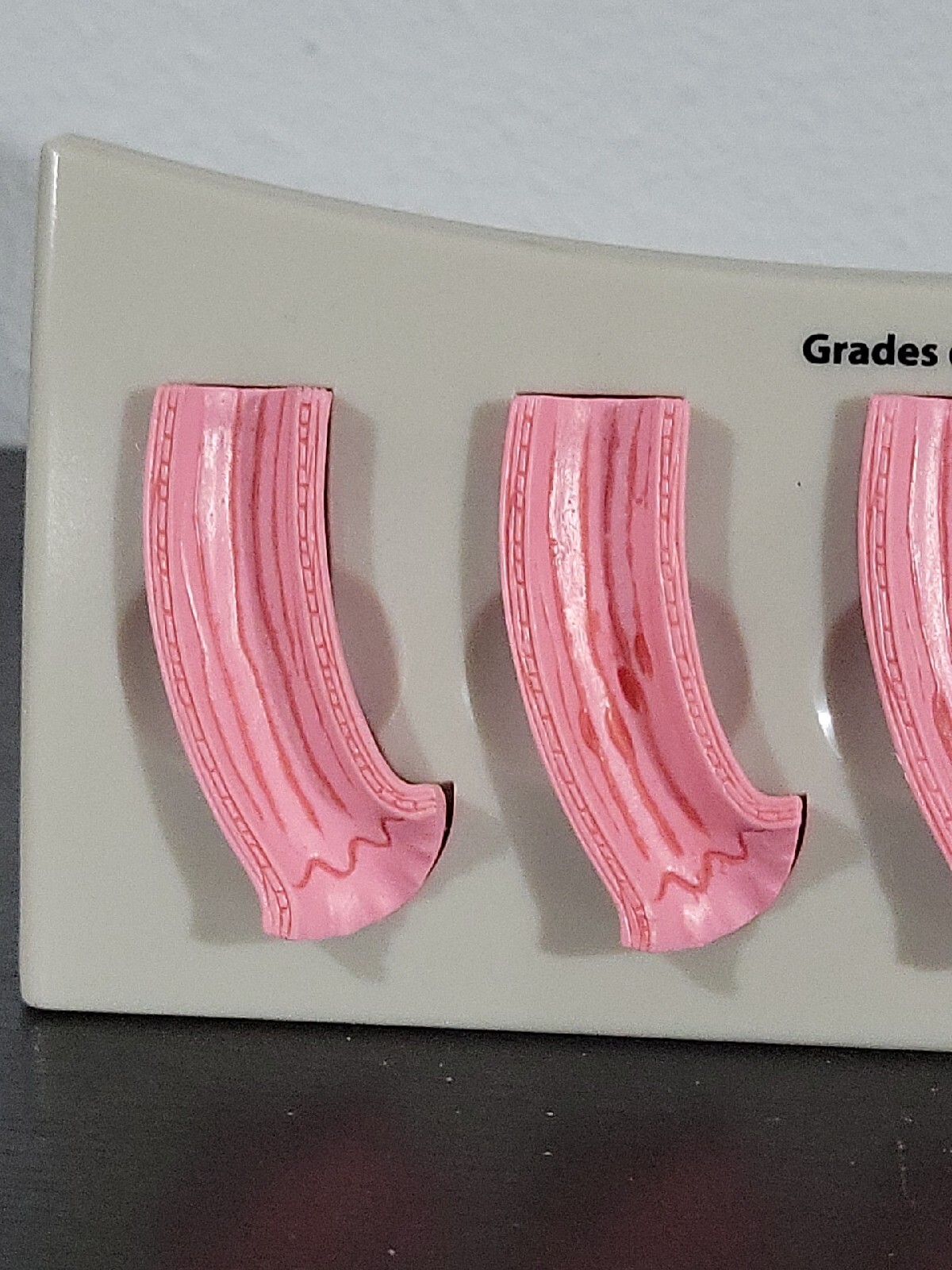 Vtg Prevacid Lansoprazole Doctor Pharmaceutical Display Grades Of Esophagitis