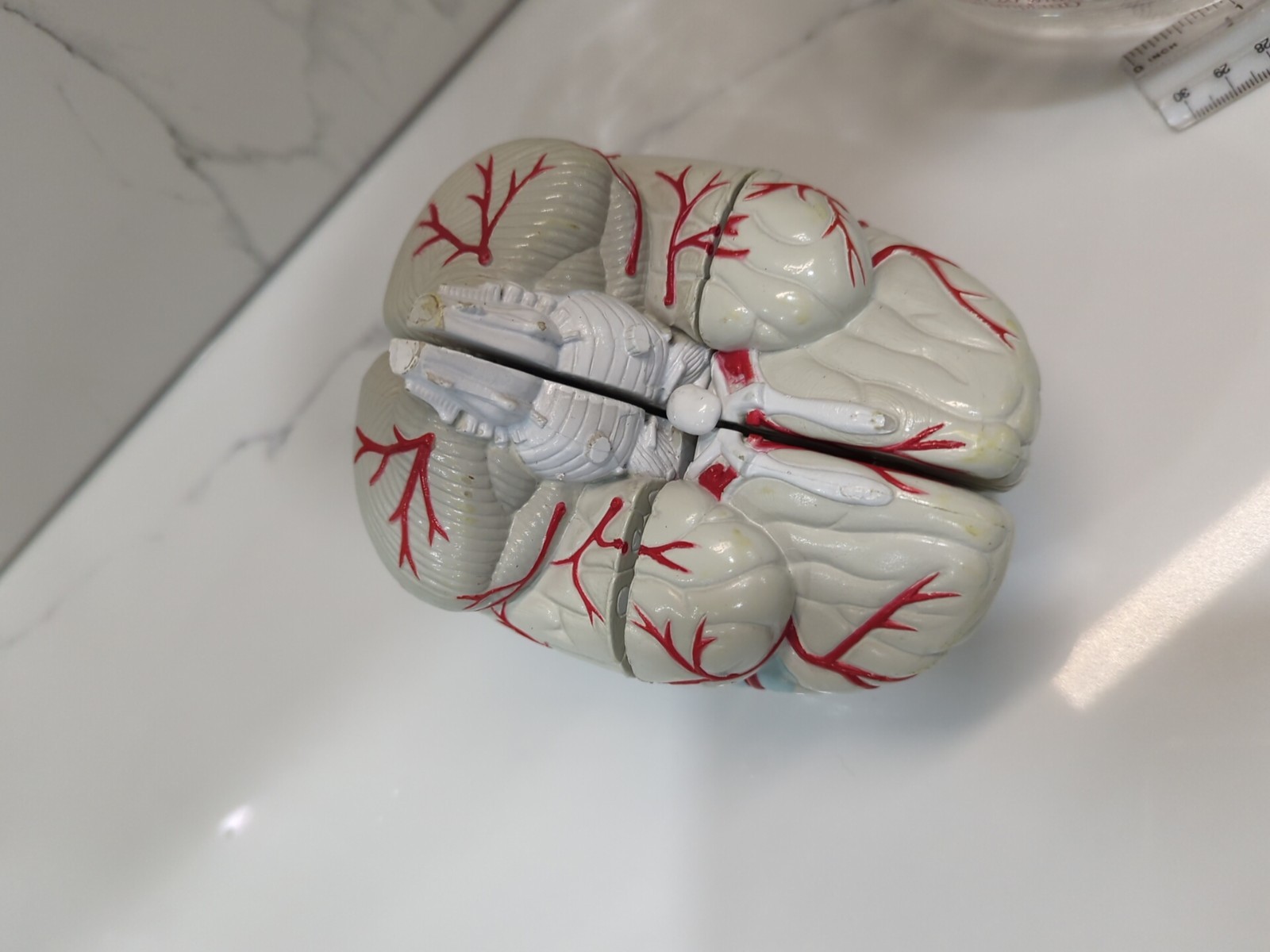 Gliadel Human Brain Anatomy Model w/ Clear Skull PharmaDesign Medical Display