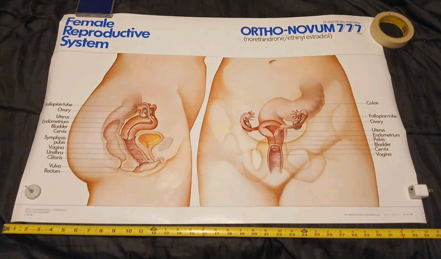 Vinatge 1986 Female Reproductive System ORTHO-NOVUM 777 20×34 Poster ORTHO…