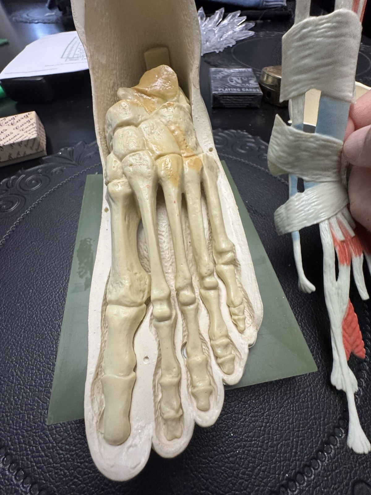 Vintage Merck Benemid/Indocin Advertising Display Foot Anatomical Store Model