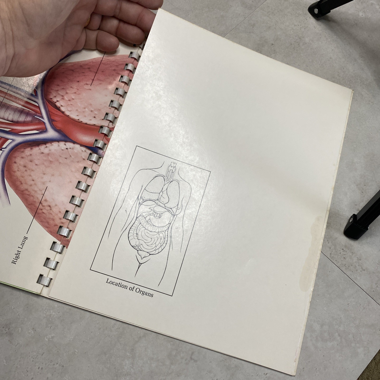 1975 Eli Lilly Pharmaceutical Medical Illustrations Of Surgical Anatomy Macabre