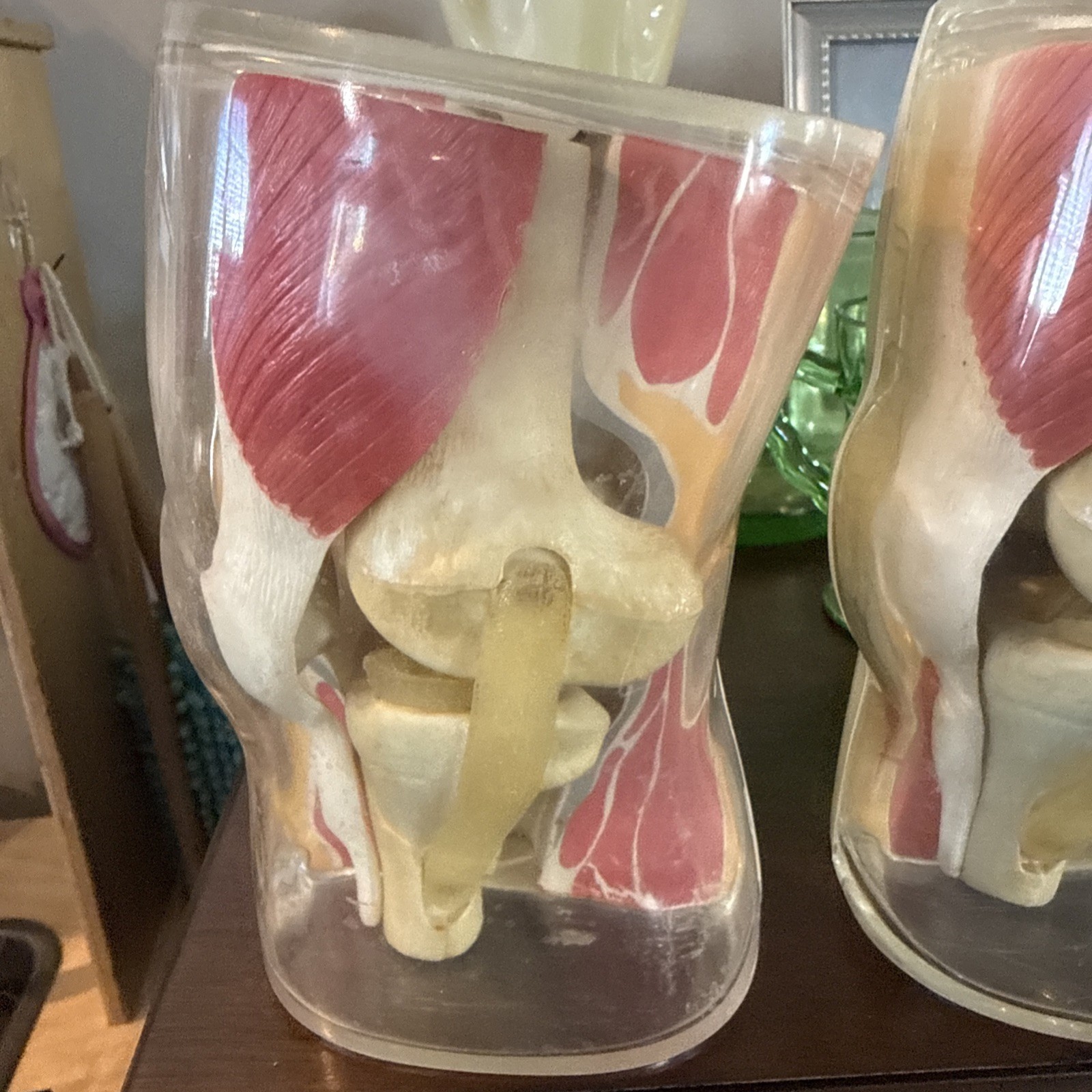 Vintage 1962 Human Knee Merck & Co Medical Anatomical Model Set Of 2 One Price