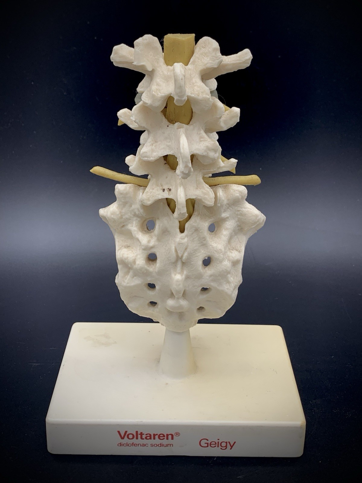Rare Geigy Voltaren Medical Advertising Spine Model – Anatomical Lumbar/Sacrum
