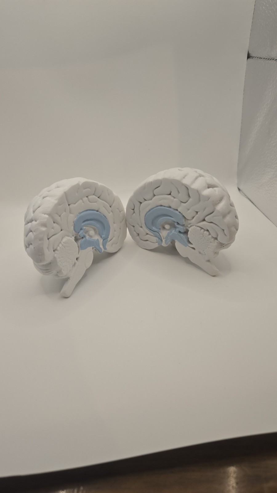 Alkermes Anatomical Brain Model Pharmaceutical Promo Desk Display