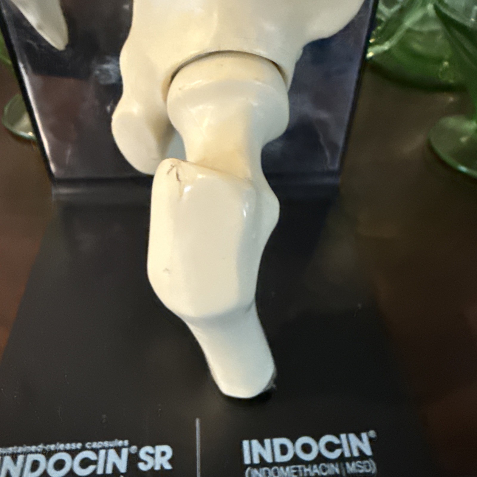 Vintage 1980’s Merck Indocin Human Hip Anatomically Correct Excellent Look