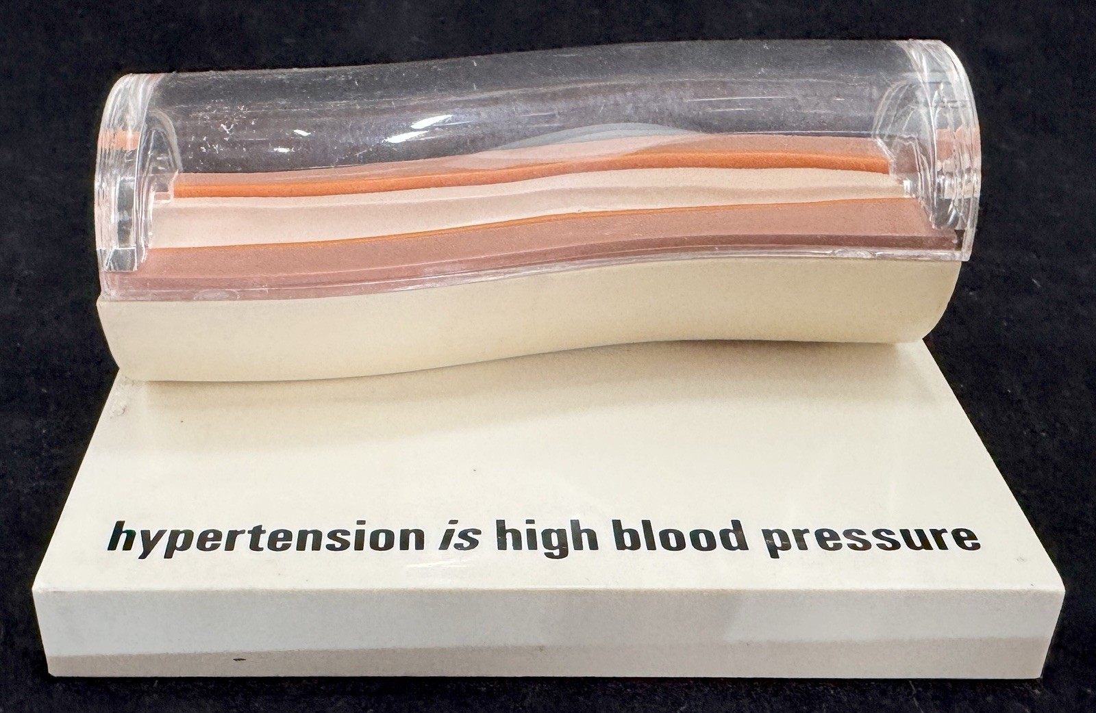 Merck MSD Diuril Advertising 3D Model Vein Artery 1976 Anatomical Sales Sample