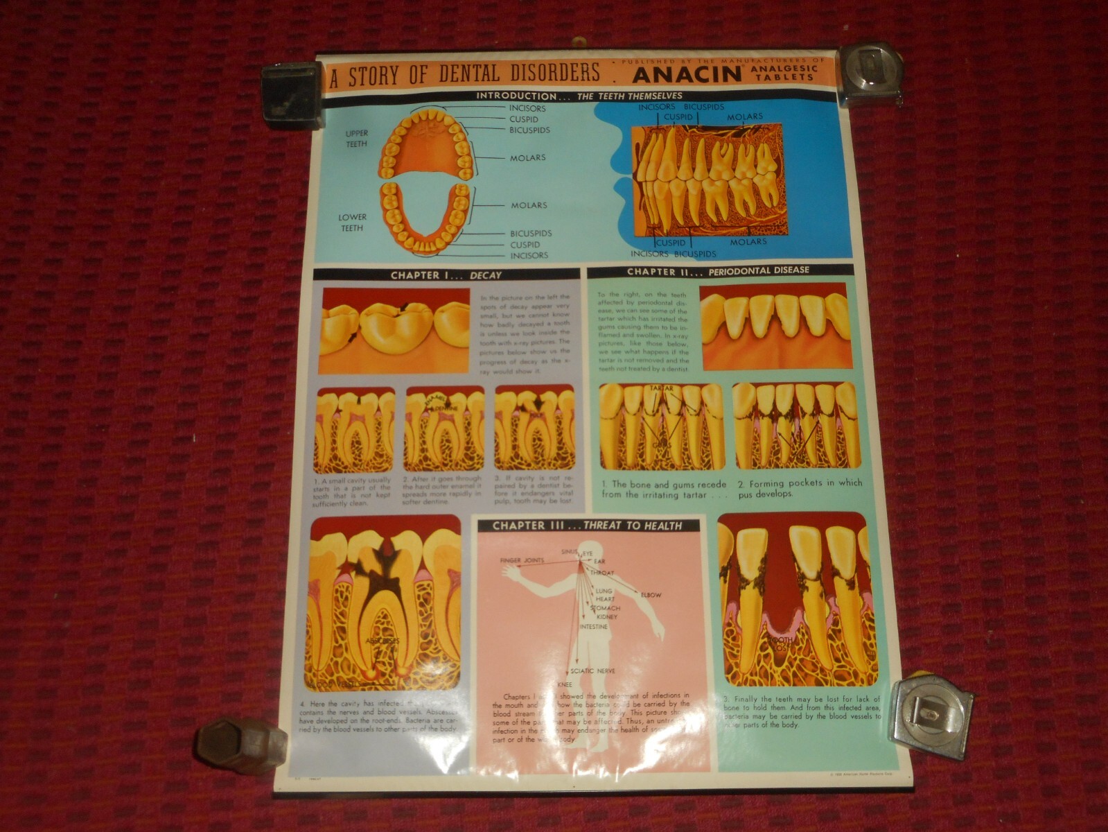 Vintage ANACIN Tablets WHITEHALL Laboratories ADVERTISING Dentist DENTAL POSTER