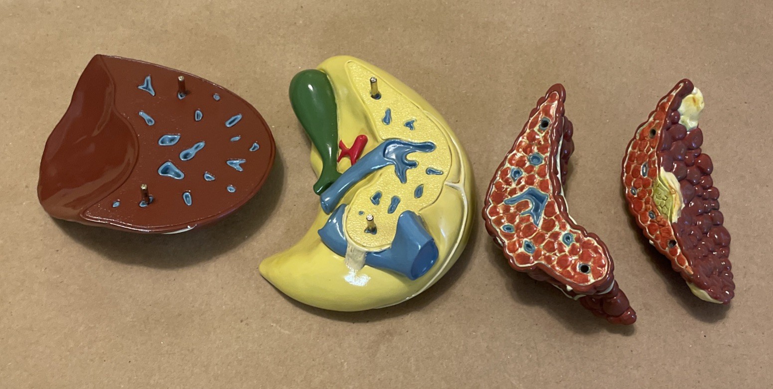 Diseased Liver Anatomical Teaching Model Schering Oncology Biotech Pharmadesign